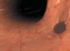 医学教学模型 医学教学模型
