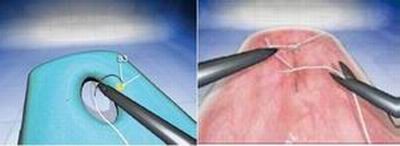 点击浏览下一页