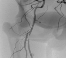 点击浏览下一页