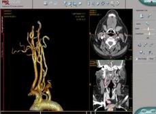 点击浏览下一页