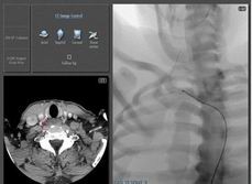 点击浏览下一页