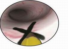 点击浏览下一页