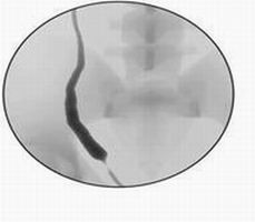 点击浏览下一页