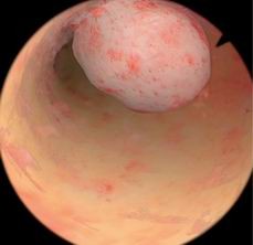 点击浏览下一页