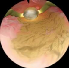 点击浏览下一页