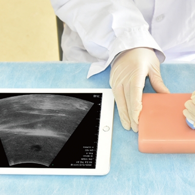 B超乳房囊肿训练模块